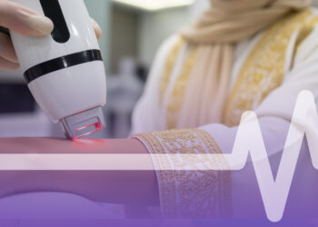 ليزر إزالة الشعر بالرياض