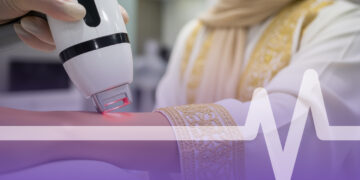 ليزر إزالة الشعر بالرياض
